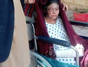 Christian girl attacked with acid after refusing conversion to Islam and marriage